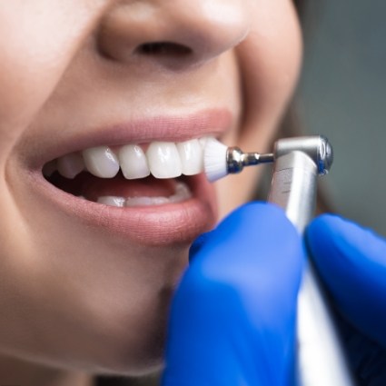 Patient having teeth cleaned for preventive dentistry in Rogers