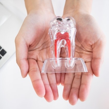 Two hands holding a clear model of a tooth