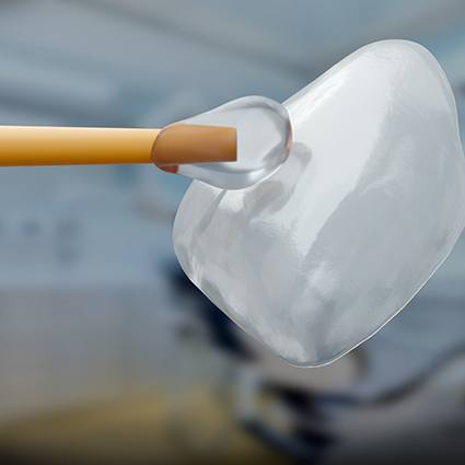 Closeup of a veneer being picked up by a stick with glue